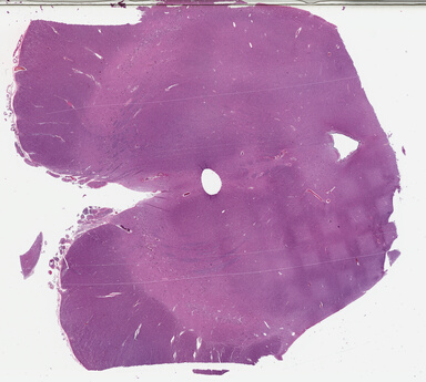 ['deident_9e78d5f7-9dc7-40ca-a871-10d13c95a983_69b03c79.jpg']