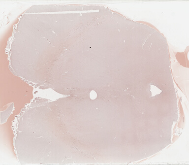 ['deident_0c48fc65-d89f-454f-970a-10ac5412ed79_69b03c40.jpg']