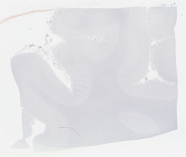 ['deident_da52e45f-4dfc-4dd2-a711-f1744f32b200_69b04dca.jpg']
