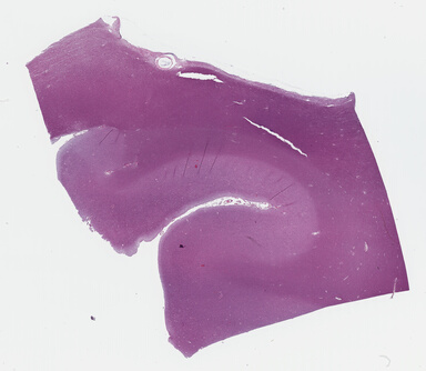 ['deident_0b9c6f4e-7590-4dd4-bc41-0e8528e90d34_69b04d86.jpg']