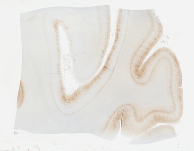 ['deident_cb0715b7-6d56-4faf-9ae9-b795526368ee_69b04dc7.jpg']