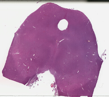 ['deident_5fc029bb-9085-44cb-935c-a2a9bdf53cee_69b03122.jpg']