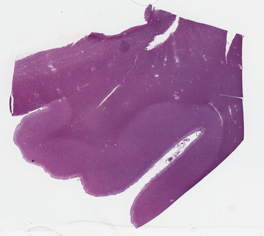['deident_094c4fd0-decc-49b5-92af-7f168aa5f37e_69b03107.jpg']