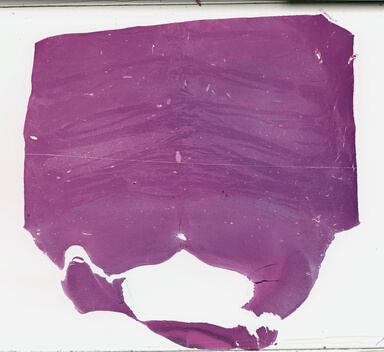 ['deident_9e6c0076-4fab-4ad0-b79e-ac5fa07e2720_69b0313e.jpg']