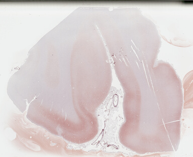 ['deident_a51ce05a-2dbd-4f22-928c-b89ba0091b1b_69b03141.jpg']