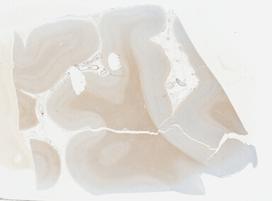 ['deident_66f7ab04-06be-479b-b295-81100bb04714_69b03128.jpg']