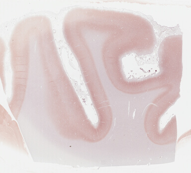 ['deident_178edbc1-e1fd-44d8-8e30-e610c0a9a266_69b0310a.jpg']