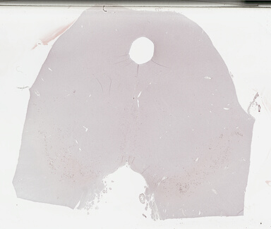 ['deident_9640b213-3067-45de-b968-760691690ed4_69b03137.jpg']