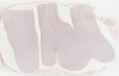 ['deident_45dc979d-92a8-46da-8148-8351c8dbd8ea_695fd353.jpg']