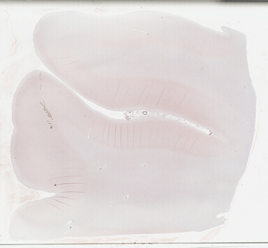 ['deident_44239536-26cc-4117-b0d6-47ef936fbae9_695fd34e.jpg']