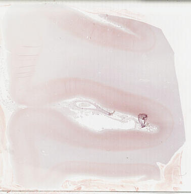 ['deident_193a2d19-248b-4f3c-8520-ccd617c01a08_695fd33f.jpg']