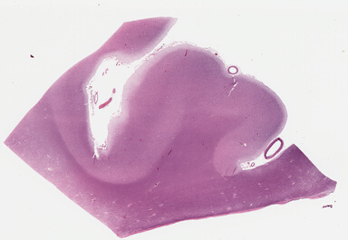 ['deident_d838beae-40aa-463e-8521-1d647fd9a049_695fd38d.jpg']