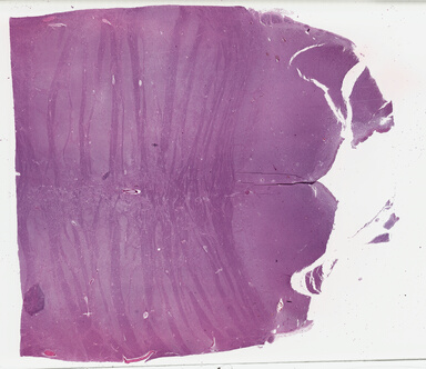 ['deident_bb46d785-024d-40b9-84e6-56e3db5f907b_695fd381.jpg']