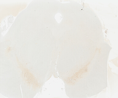 ['deident_ca6cff90-0289-4f08-9141-07f26a5416bc_695fccd5.jpg']