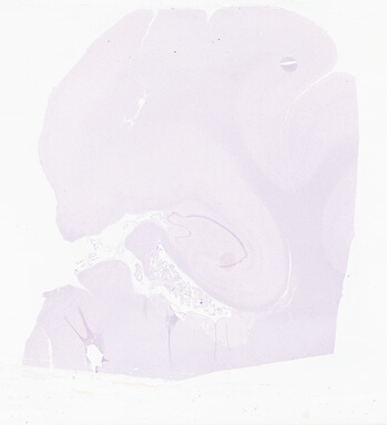 ['deident_0eb7a256-0d64-418a-a490-85a387050e56_69d9664a.jpg']