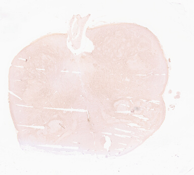 ['deident_82e43c86-34f3-4924-8c65-d24f531b33f5_69d9667c.jpg']