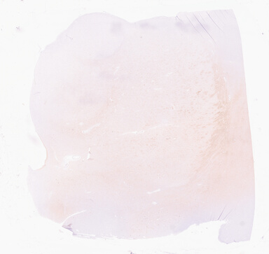 ['deident_da9750f4-4f3d-4493-b94f-edcf8bb815bf_69d966b2.jpg']