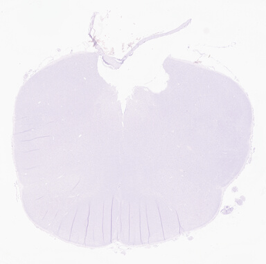 ['deident_5a54880f-cace-4c3e-b9e0-05243564fd71_69d9666b.jpg']