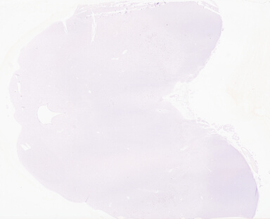 ['deident_67154020-0212-4cf9-9cc5-3259001f51f4_69d96674.jpg']