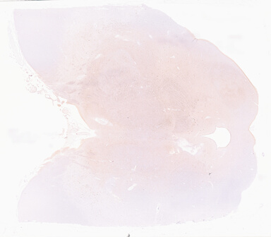['deident_8034ed9a-3a5c-49af-87ed-57e52a842ce4_69d96679.jpg']