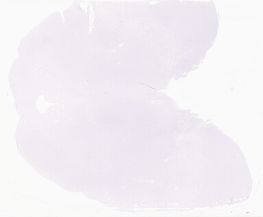 ['deident_cfcf84ae-7f1d-4996-a29d-16cc5b1a7308_69d966a6.jpg']