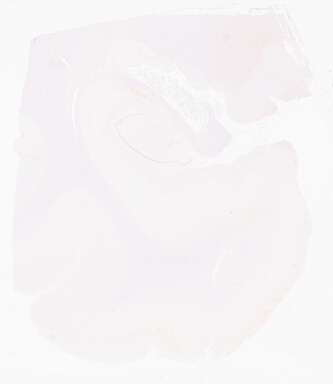 ['deident_6386738c-d758-4ca4-9921-a553ffb91c5b_69d96672.jpg']