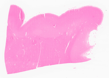 ['deident_87468e81-64c0-4ada-bb01-4724c5f8560d_69d9618b.jpg']