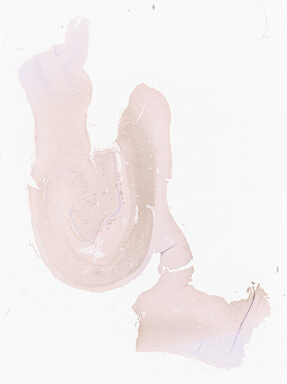 ['deident_1730787f-afde-4f0a-a5b3-ee8496c12e32_69d96147.jpg']