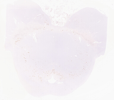 ['deident_0cd9c577-36df-4ae1-90fc-2d8bd10dc146_69d96140.jpg']