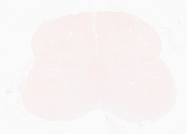 ['deident_723e51bb-1f15-4e8f-bedc-f72f68d95301_69d96175.jpg']