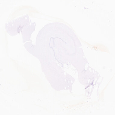 ['deident_805ed3cb-cbf4-49fd-9298-78ec3bc9249a_69d96186.jpg']