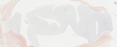 ['deident_e9611ac8-92d7-4435-abfe-eb6e25d5fe76_69b04561.jpg']