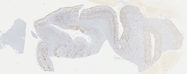 ['deident_1c51a3a3-6aa0-4a86-ab39-c9545b79923c_69b04527.jpg']