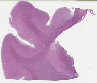 ['deident_856bfa47-19f2-4fa3-9761-14067b8912d0_69b04545.jpg']