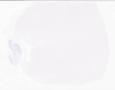 ['deident_bdc827db-6f9f-4fc1-8ce1-f6ea0c52af79_69b049a5.jpg']