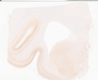 ['deident_0cd8fdd7-ba3a-4d3e-bcd7-4d958b561252_69b05486.jpg']