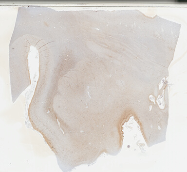['deident_d92a0d41-f8b6-4916-a8cc-82b8fdc3d5b7_69b03fb6.jpg']
