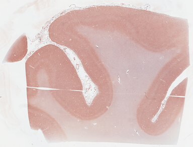 ['deident_fea2afa6-a6fd-4a2f-b5d5-fdbf1caaffb9_69b031a1.jpg']
