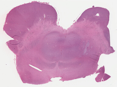 ['deident_7a034a01-c9c3-46af-b103-db8176a4272c_695fc24d.jpg']