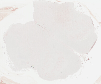 ['deident_a42bde14-f320-4668-9948-af71c397faf7_695fc255.jpg']