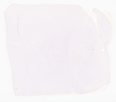 ['deident_ad2ac227-d3f0-4d2f-8863-7916e067859c_695fc25e.jpg']