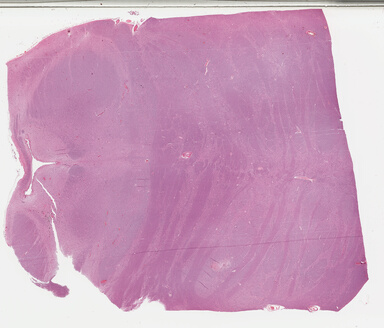 ['deident_0f20bce8-d061-4f00-a5d4-5bfec63aaabe_695fc22d.jpg']