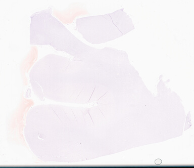 ['deident_bb4c8677-9e6c-48e1-af8c-4cf916fb7fae_69d95dc8.jpg']