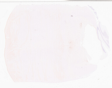 ['deident_fa52df36-ab40-46f2-87cf-b3753d2b63f9_69d95ddc.jpg']