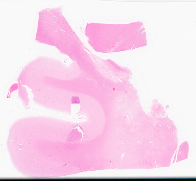['deident_32270aab-1576-49d0-a46f-c4ab13ae0e5a_69d95d86.jpg']