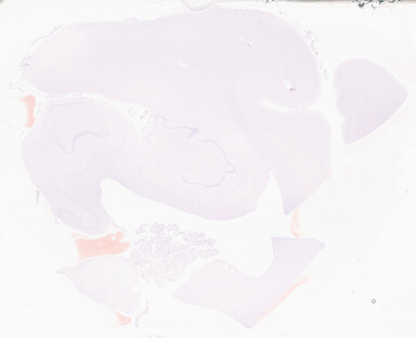 ['deident_241deb58-717f-4bcc-8a89-eb07c0a50247_69d95d79.jpg']