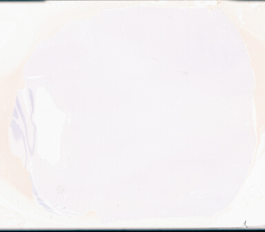 ['deident_54ff2961-1dd9-40a9-ba98-f6b9f5c29b0f_69d95d8c.jpg']