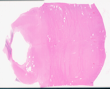 ['deident_871c0ca5-76ca-403f-8dcb-9806c335e7a0_69d95daa.jpg']