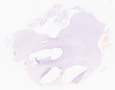 ['deident_68a0e9ef-9ff8-48c9-a1e1-c06f280382c4_69d95d9d.jpg']