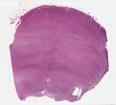 ['deident_6d9f3005-ae5c-447b-89c8-3e60c3486e37_69b04e69.jpg']